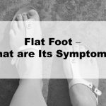 Flat Foot – What are Its Symptoms?