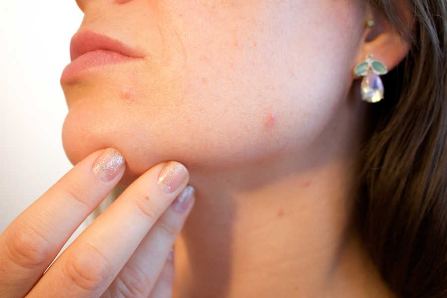 Worsened Skin Conditions: What’s The Reason?